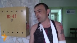 Хотели свести татуировку разбитой лампочкой
